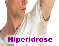 Hiperidrose ou suor excessivo 4