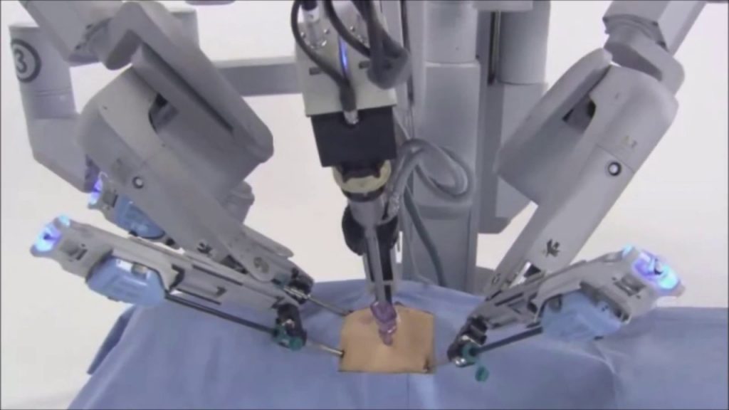 Cresce uso da robótica no tratamento de obesidade mórbida CBN Campinas FM