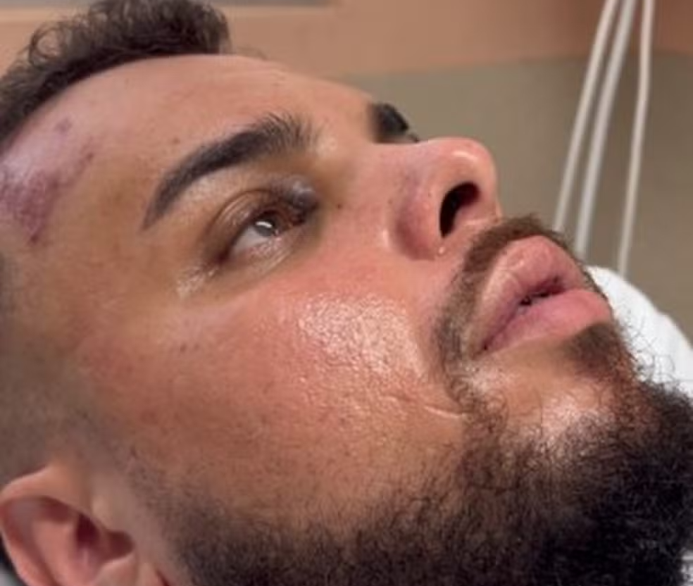 Torcedor ferido no dérbi entre Guarani e Ponte Preta recebe alta e volta para casa